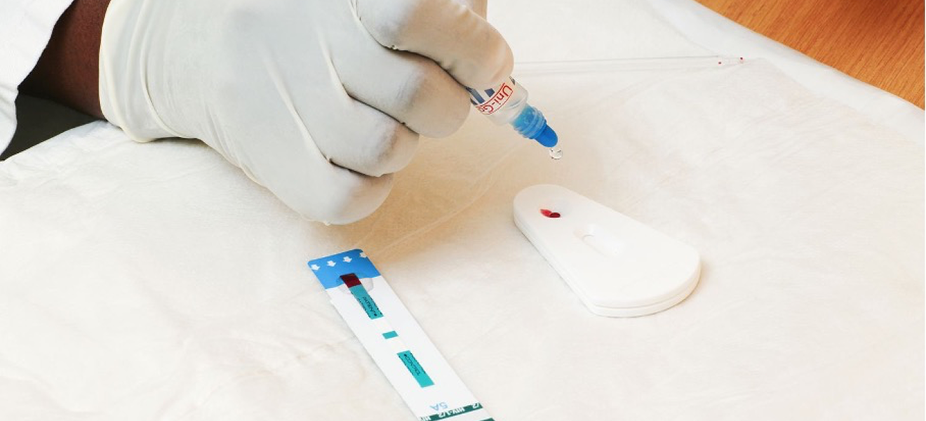 Nahaufnahme: Eine Hand mit Gummihandschuh, die aus einer kleinen Flasche eine Flüssigkeit auf ein Testkit tropfen läßt. Daneben liegt ein Teststreifen.